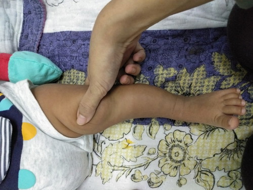 Risau kaki anak