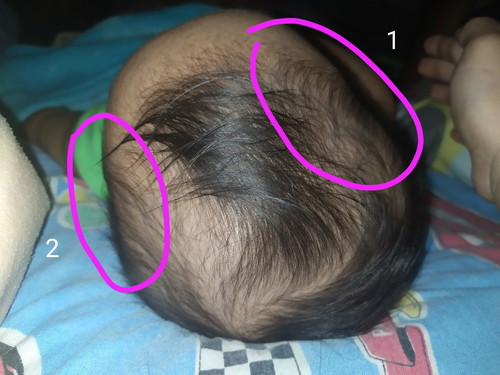 Baby Head