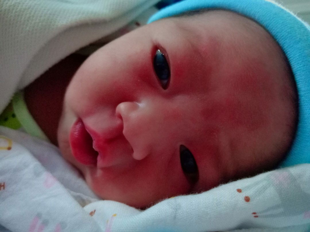 แชร์ประสบการณ์ คลอดก่อนกำหนด 35w.