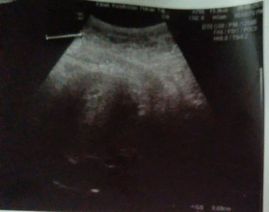 7week baru nmpk kntung normal ke??