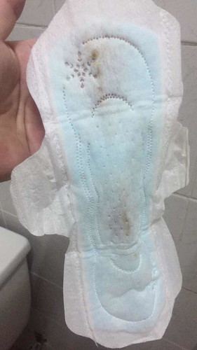 ขอโทษค่ะถ้าภาพไม่สุภาพ