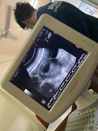 6 สัปดาห์ไม่เห็นตัวน้อง กังวลมากเลยค่ะ