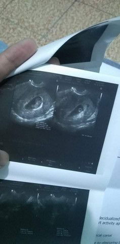 @fuckubitch profile icon