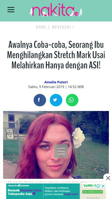 menghilangkan strechmark