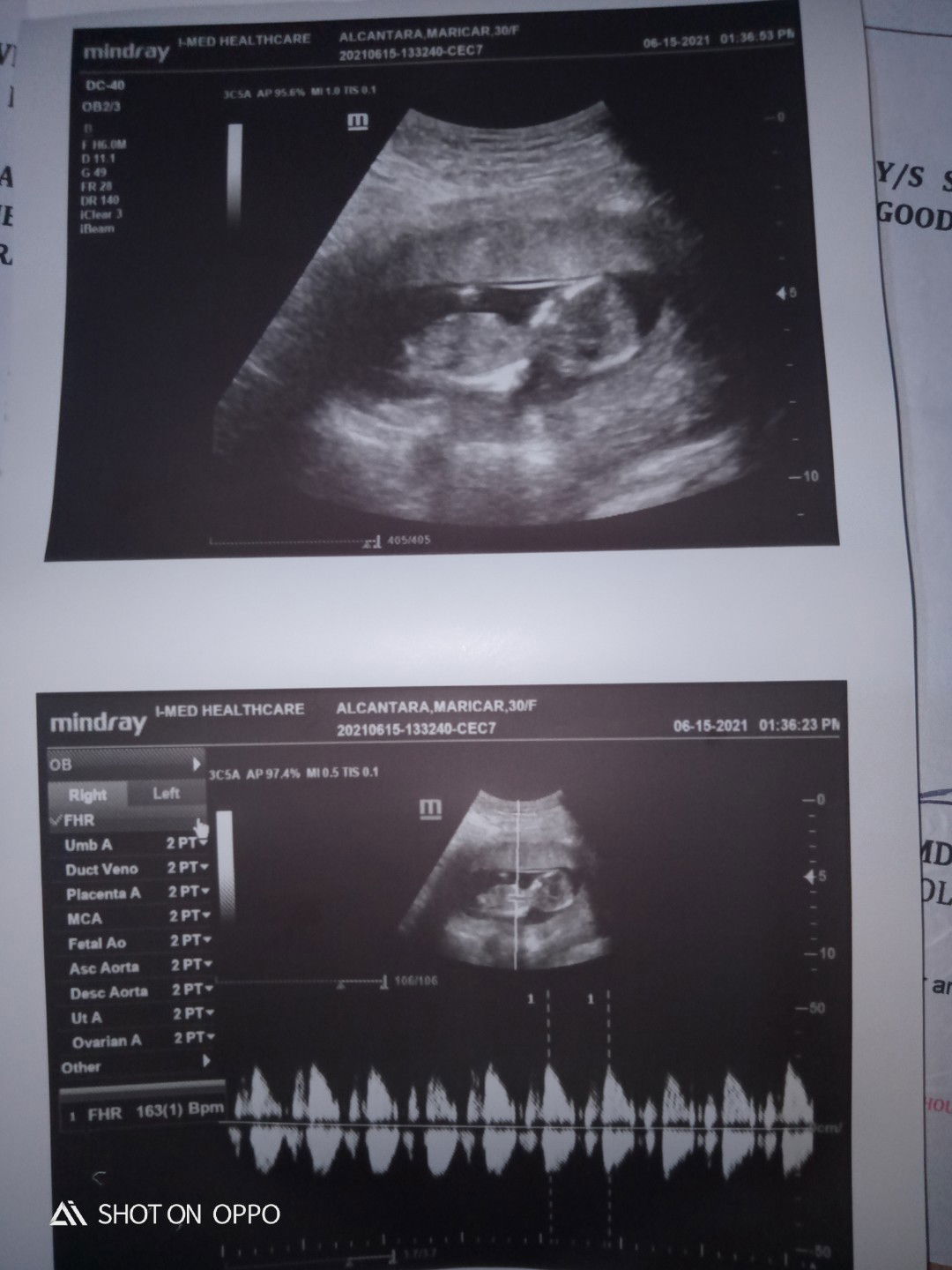 Maricar Alcantara-frio profile icon