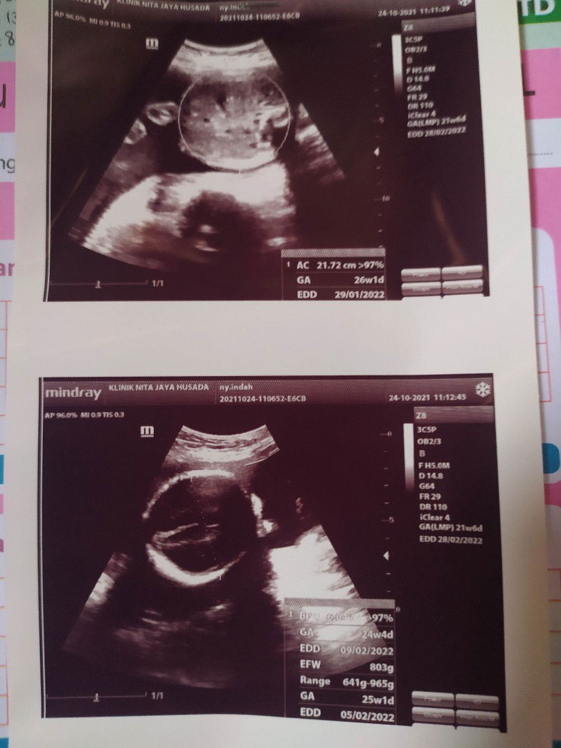 Ikhaolla profile icon