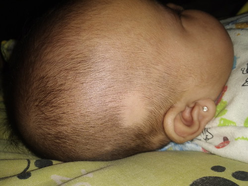 rambut bayi pitak