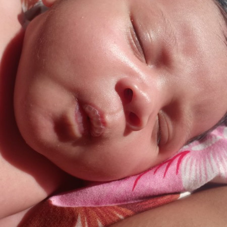 bibir kering bayi