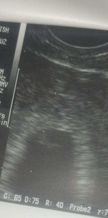 Nasan po kaya dyan si baby?