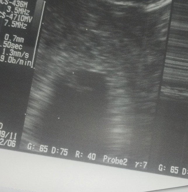 Nasan po kaya dyan si baby? Ano ano rin po feel nyo ngayong 2nd months nyo?