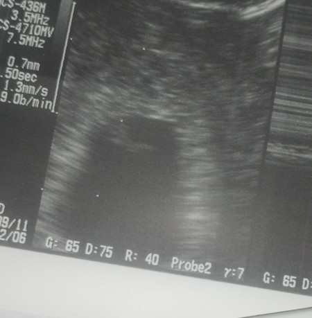 Nasan po kaya dyan si baby? Ano ano rin po feel nyo ngayong 2nd months nyo?