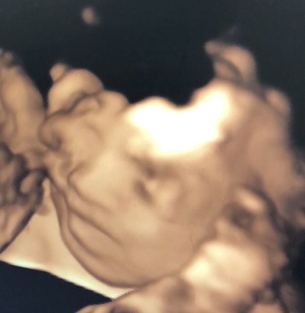 Federissa profile icon