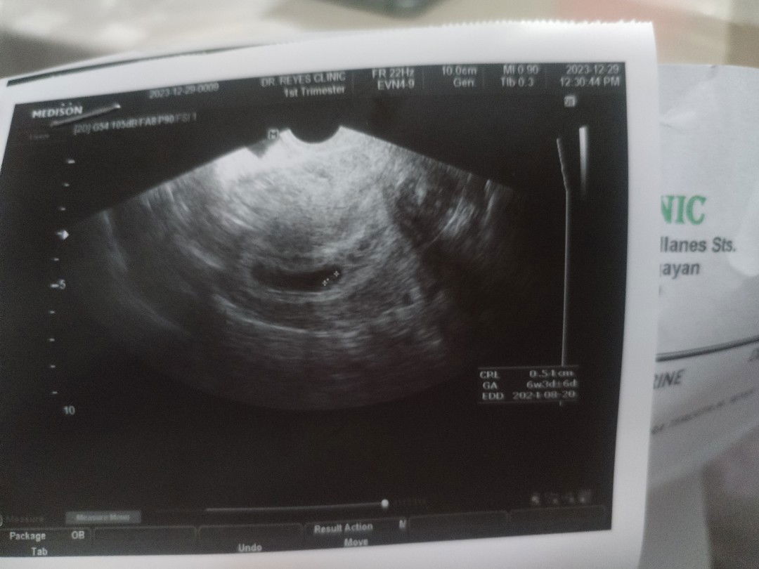 Katrine Gonzales Uy profile icon