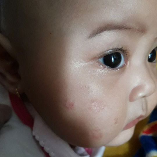 Muka bayi merah