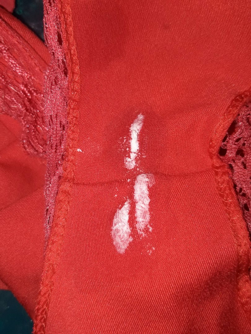 flek putih tidak berbau