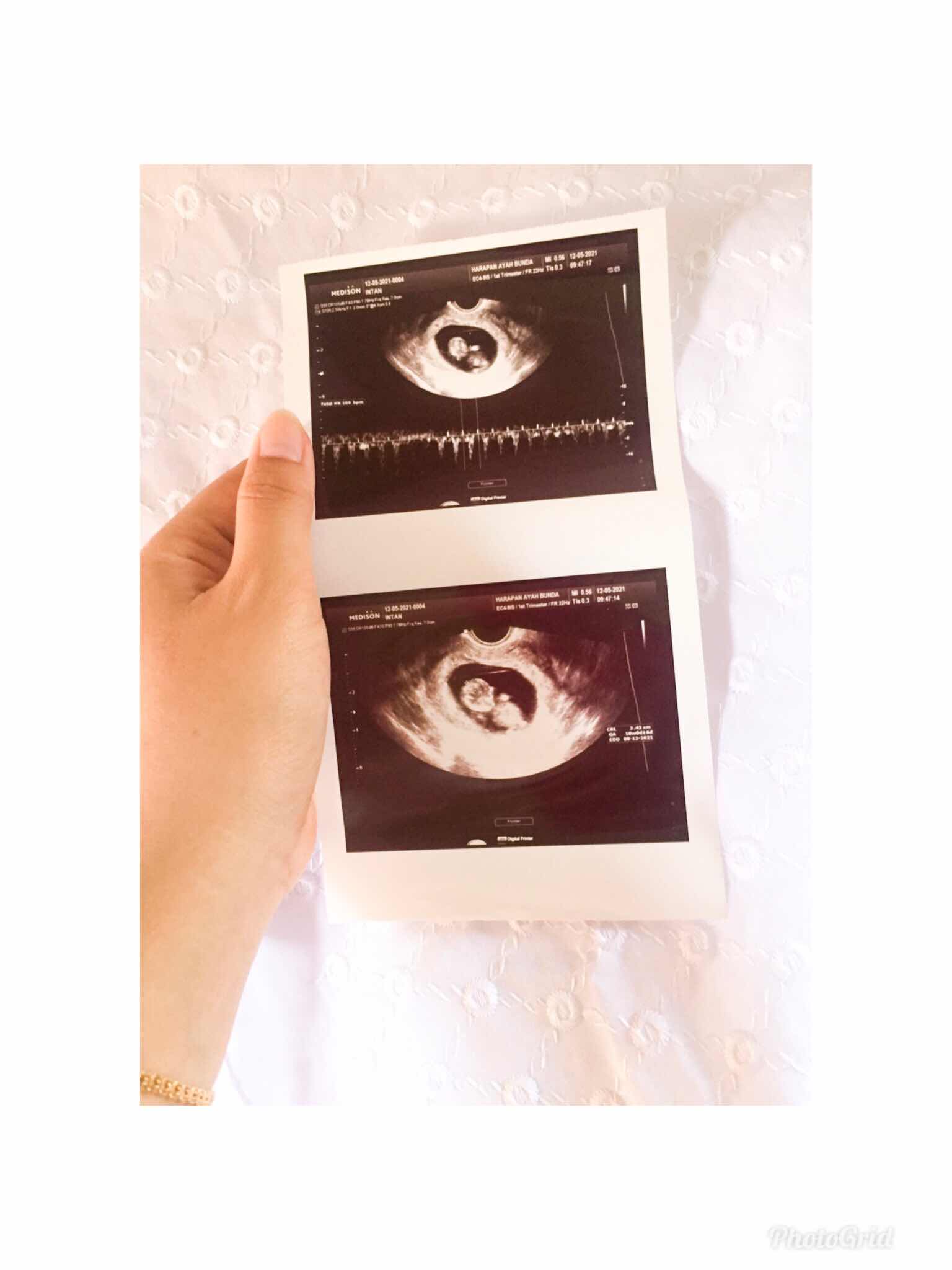 intan Andriani profile icon