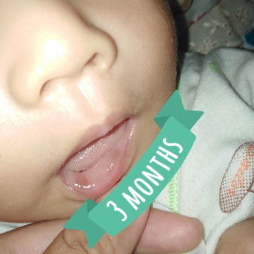Bibir Bayi Kecoklatan