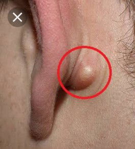 pa help mga momshie ?