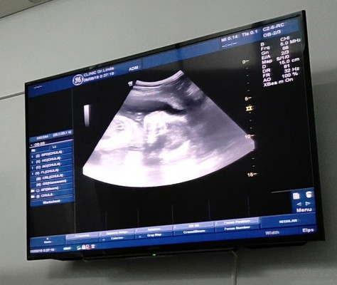 ขอดูรูปลูกบ้านอื่น ที่มีจมูกโด่งๆกันบ้าง