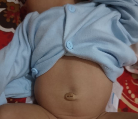 Perut bayi 1 bulan
