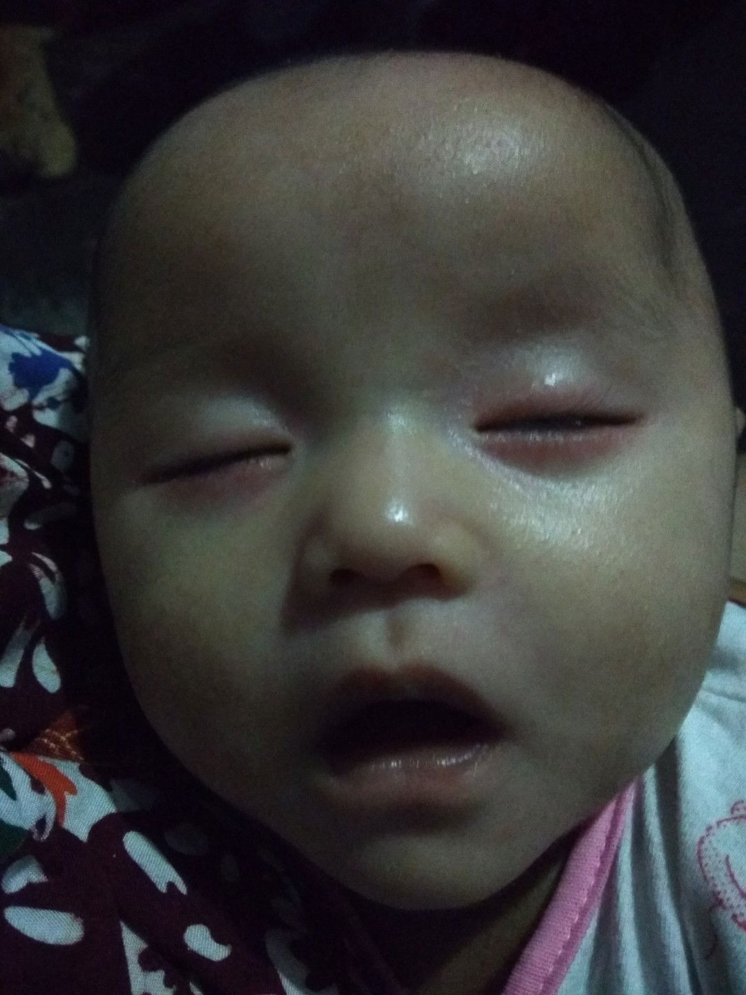 mata tiba2 merah n bengkak