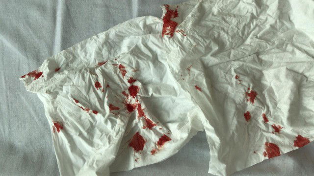 mimisan setelah operasi caesar