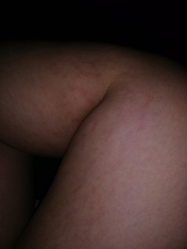 Ano po gamot sa ganto??