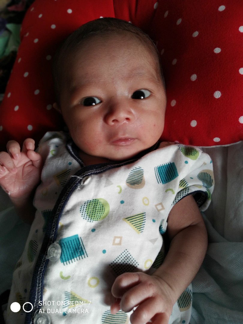 Discharge check kuning baby