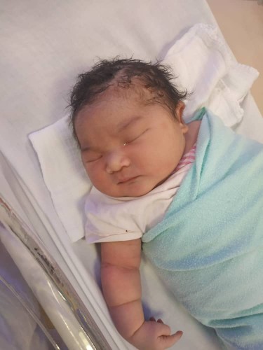 Macrosomic Baby