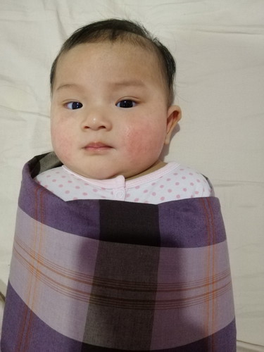 Ruam Di Pipi