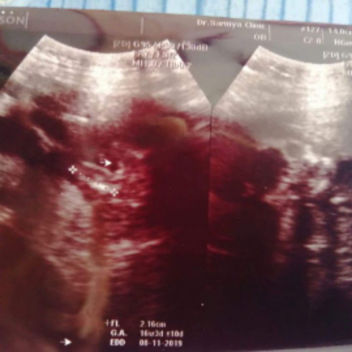 แม่ๆคิดว่าน่าจะเพศไหนค่ะ