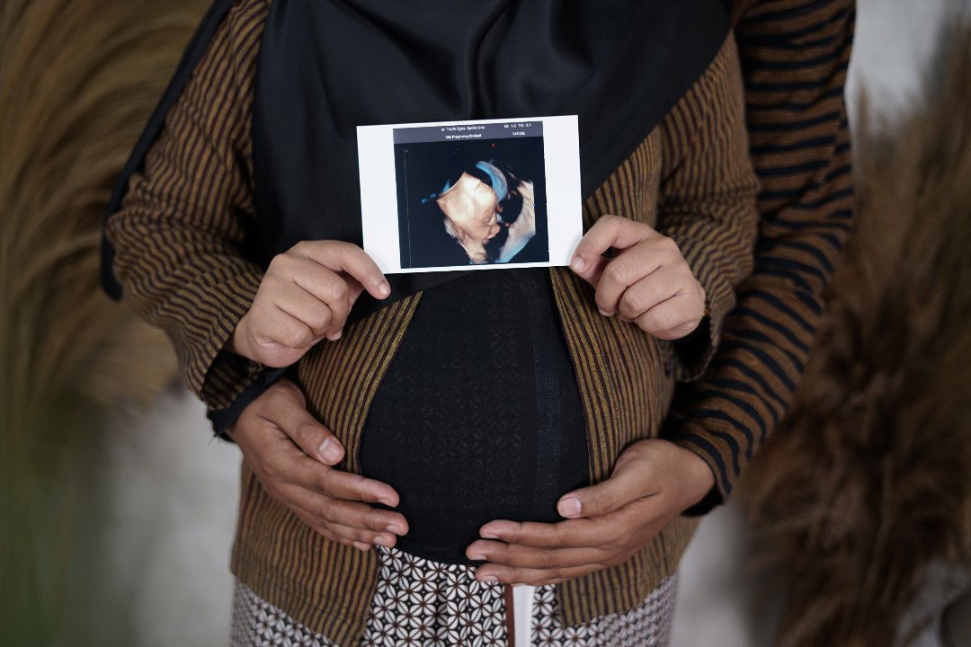 Listin Meilandari profile icon