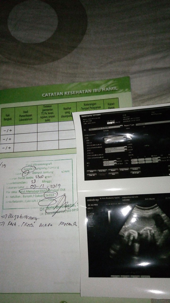 ketuban sedikit dan kepala belum masuk panggul