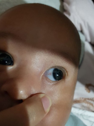 mata bayi merah