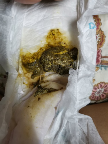 Warna Najis Baby Makan Buah Pisang