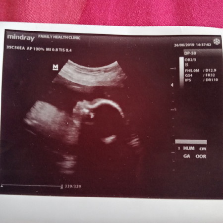 Little one ??