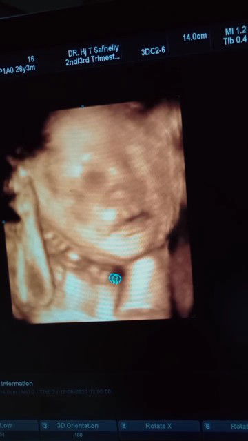 Fatunia Nia profile icon