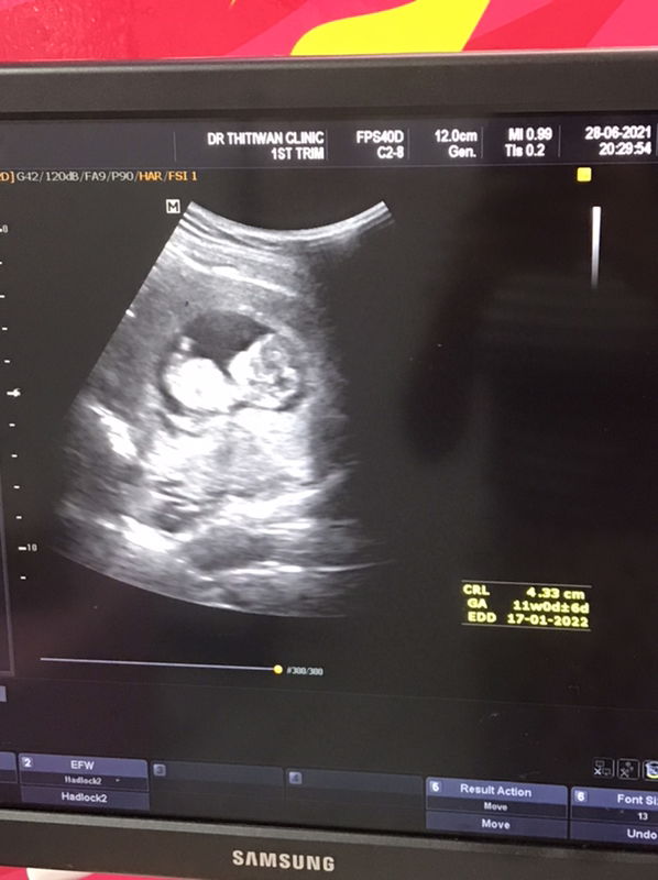 ศศิ profile icon