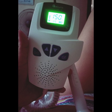home doppler