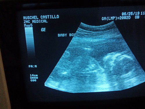 it's a baby boy.. 20 weeks and 2days..