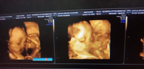 cant wait to meet you my mini me