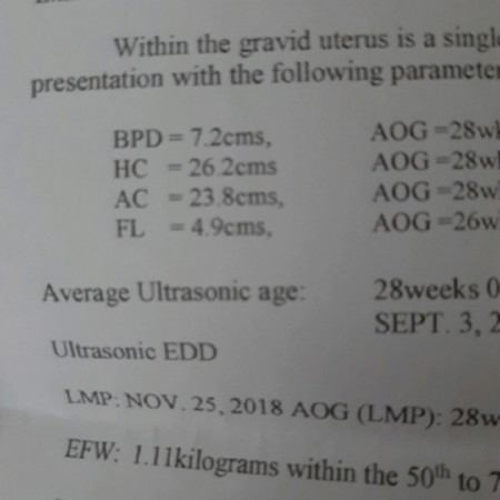 FL?