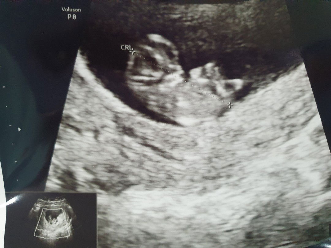 Lydia Febriani profile icon