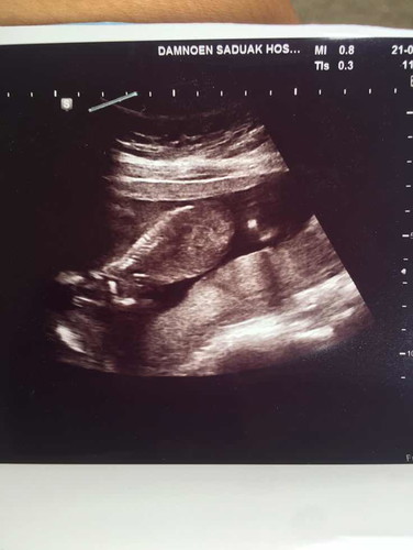 แม่ไช่วยดูหน่อยคะ