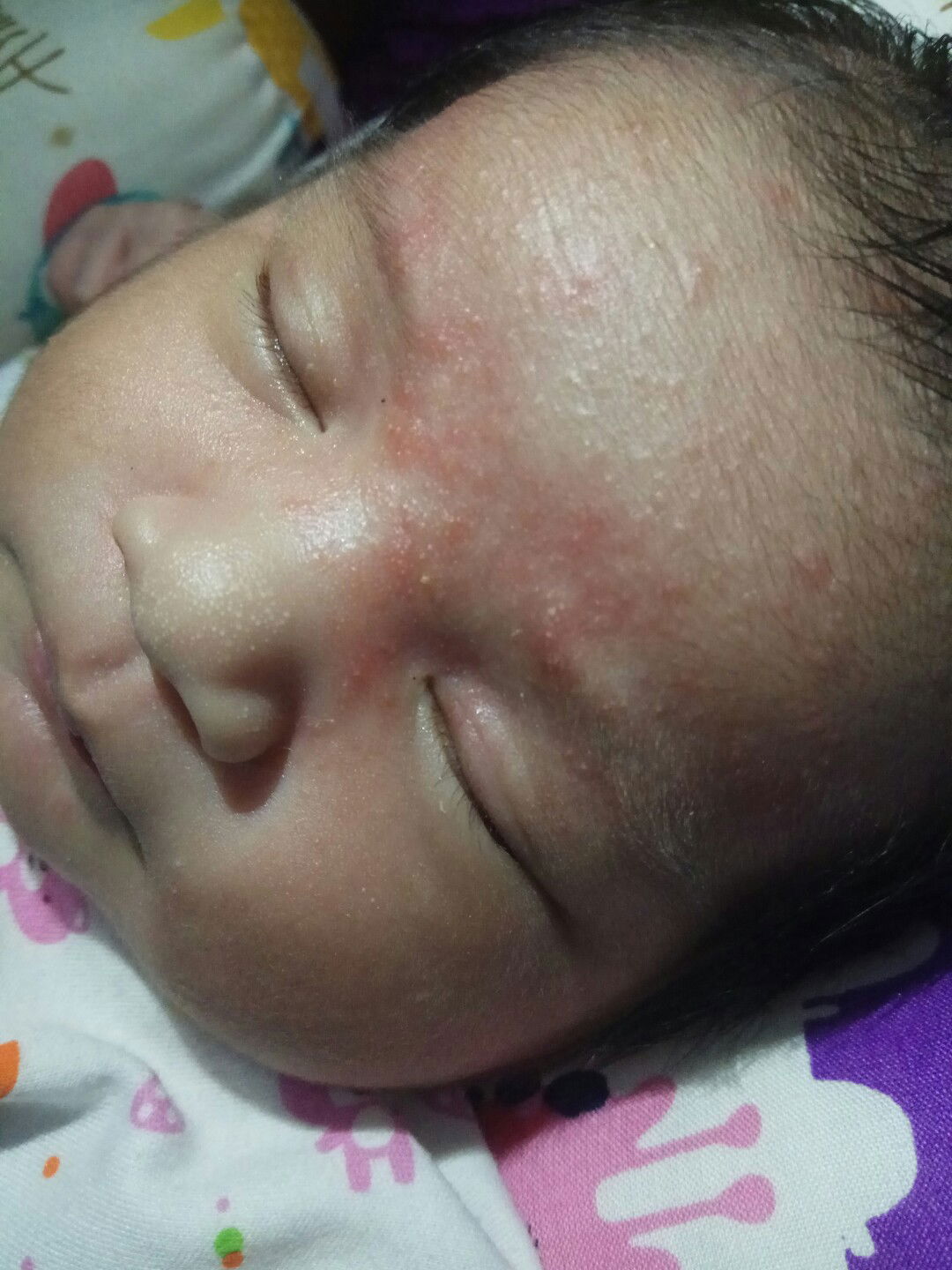 badan bayi ku merah2