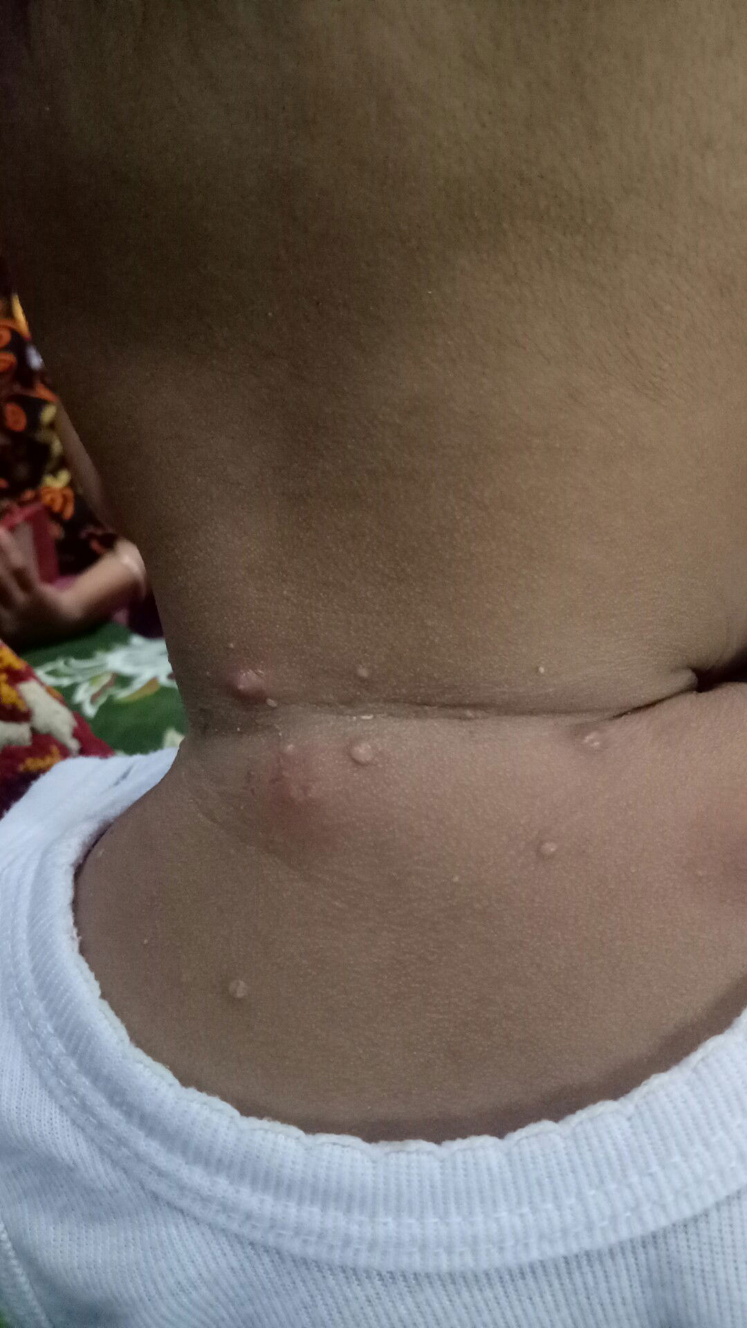 kulit bayi 4,5 bulan