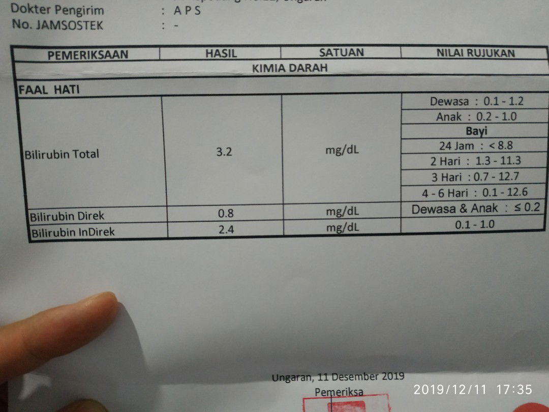 Tolong, ada yg bisa baca hasil Lab Bilirubin