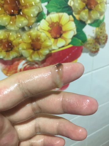 มีมูกออก แต่ไม่เจบท้อง