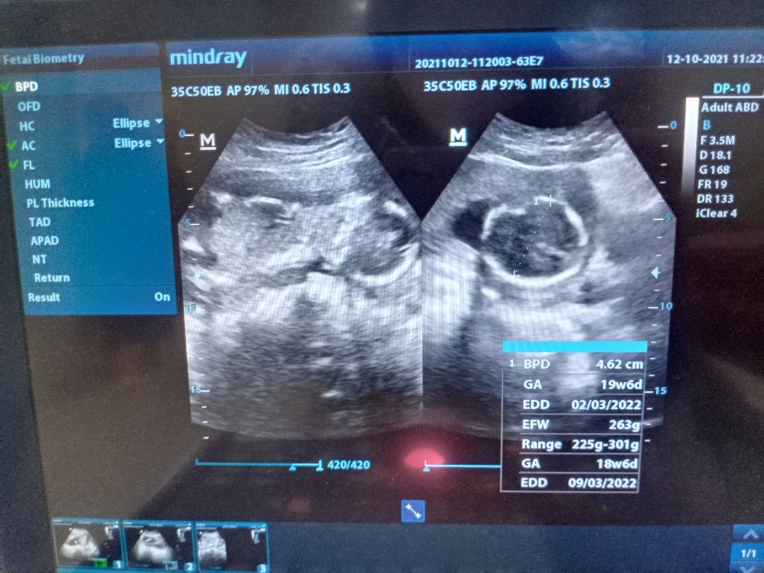 iis nafsiyah profile icon