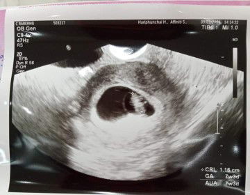 chanthika profile icon